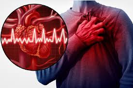 Cardiac Arrest vs Myocardial Infarction